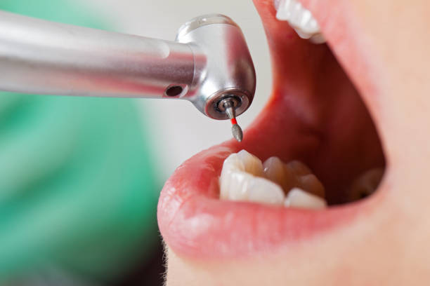 Best Cracked Tooth Emergency Dentist  in Maunawili, HI